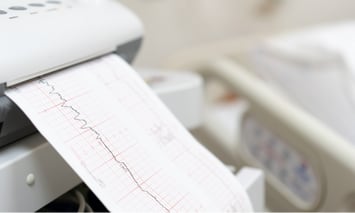 Fetal heart rate monitoring claims
