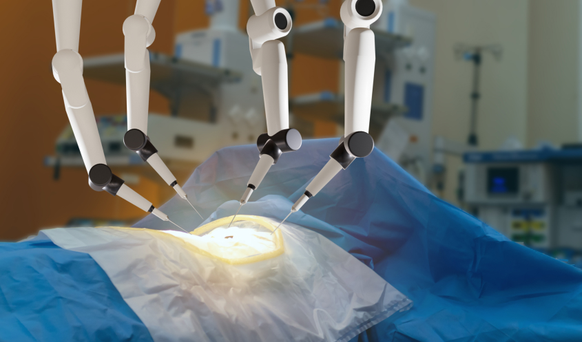 AI assisted surgery can lead to malpractice claims.